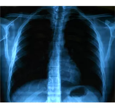 T-shirts imprimé radiographie thoracique - TenStickers